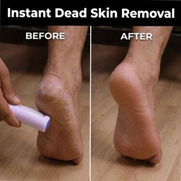 Rechargeable Dead Skin Remover For Feet (RFF7)