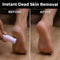 Rechargeable Dead Skin Remover For Feet (RFF7)
